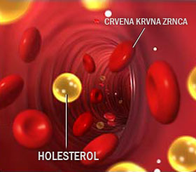 holesterol